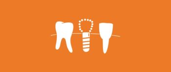 Icon zeigt ein Zahnimplantat im Kiefer