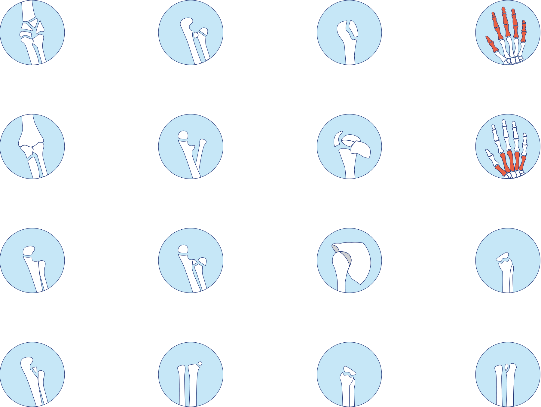 Entwicklung von Icons für Knochenbrüche am Ellenbogen, der Hand und Oberschenkel